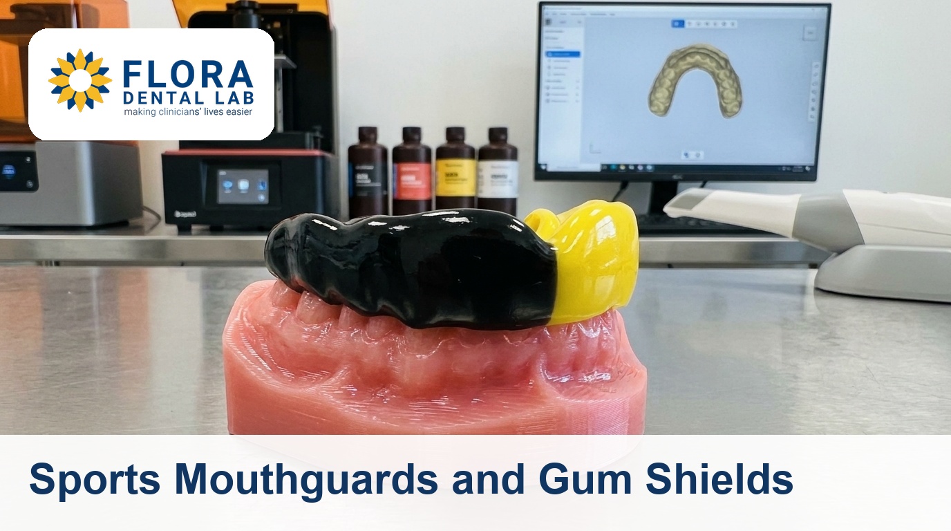 Custom thermoformed sports mouthguard on a 3D-printed resin dental model in a digital lab